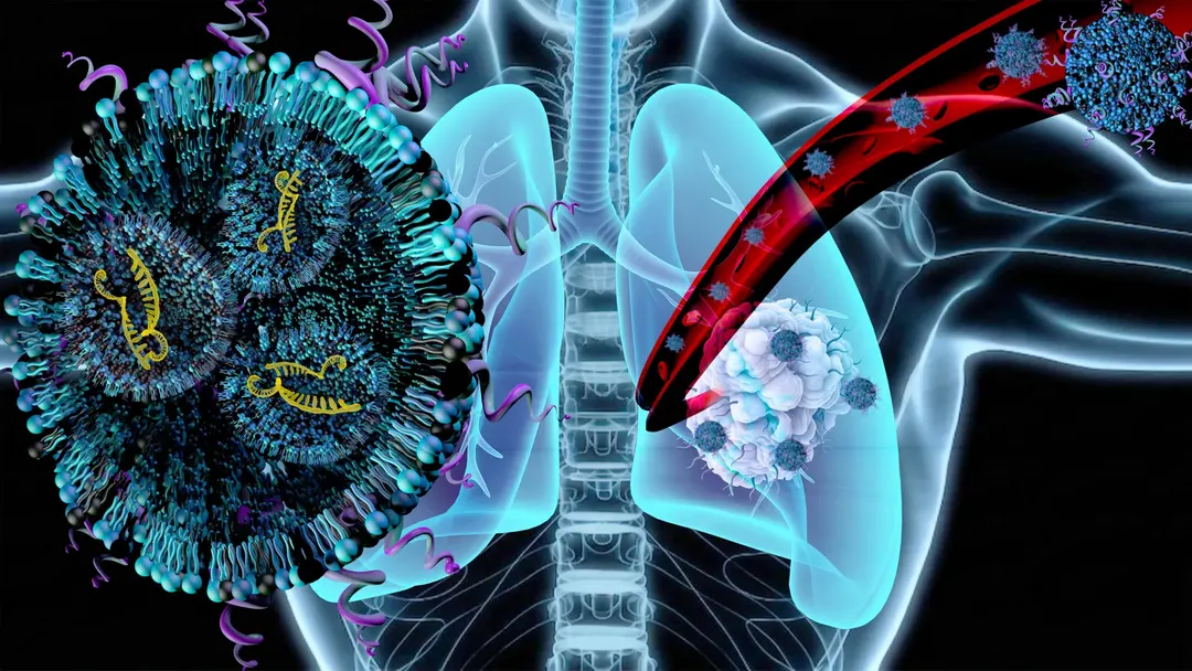 Наночастицы с mRNA лечат рак лёгких и мышечную атрофию одновременно