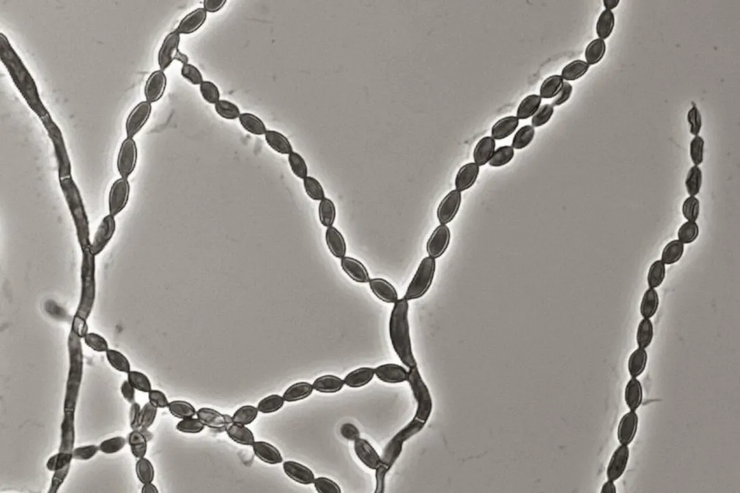 CDC: случаи смертельной плесени Cladophialophora bantiana резко выросли с 2023 года