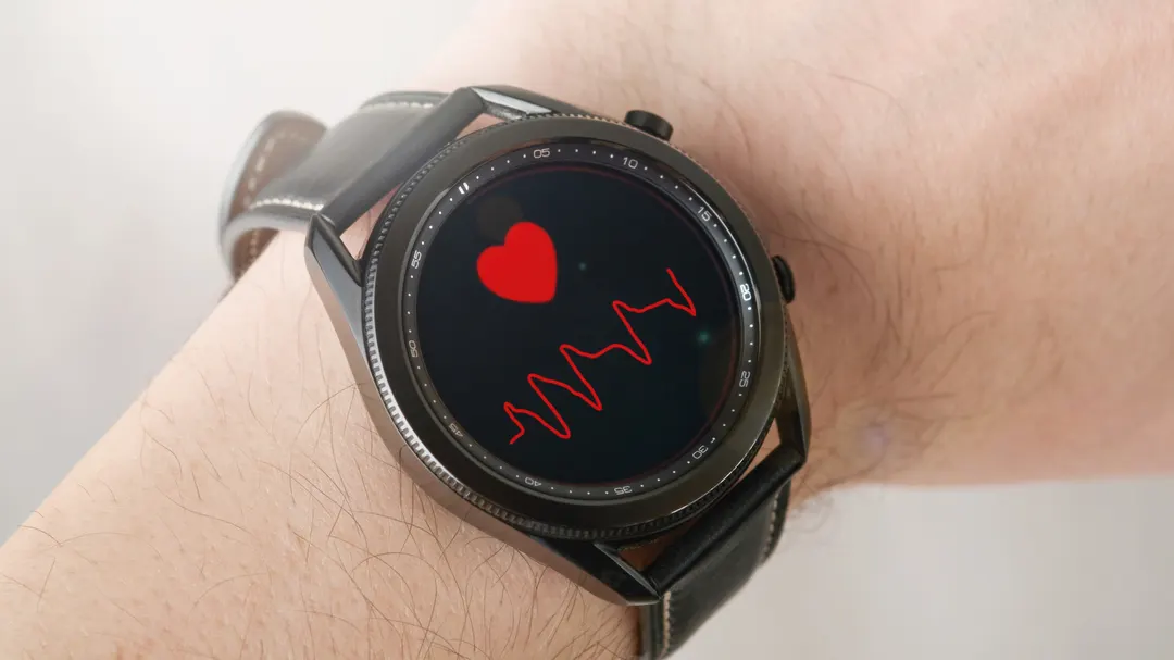 Galaxy Watch 4 Classic выявил мерцательную аритмию до операции на сердце