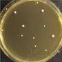 Candida auris копирует весь геном, чтобы выжить при лечении