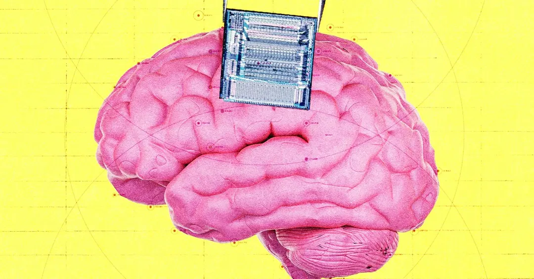 Coherence Neuro привлекла $45 млн на ИИ и импланты для борьбы с опухолями мозга