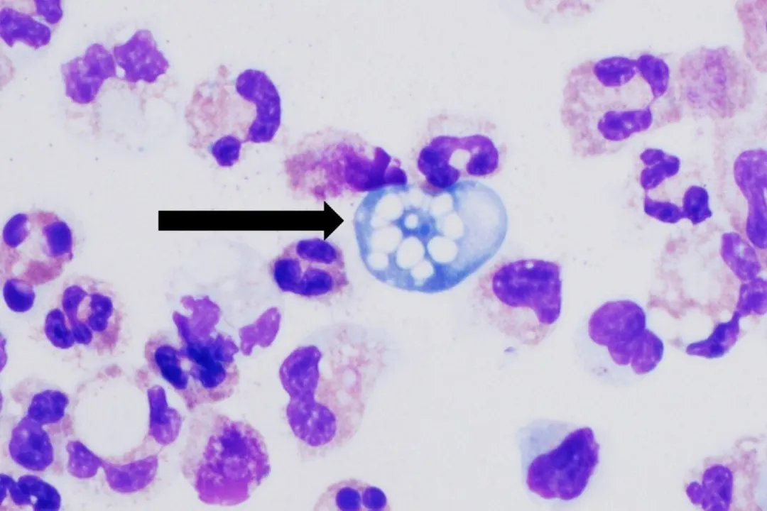 Соединение из морских бактерий убивает амёбу Naegleria fowleri за 4 часа