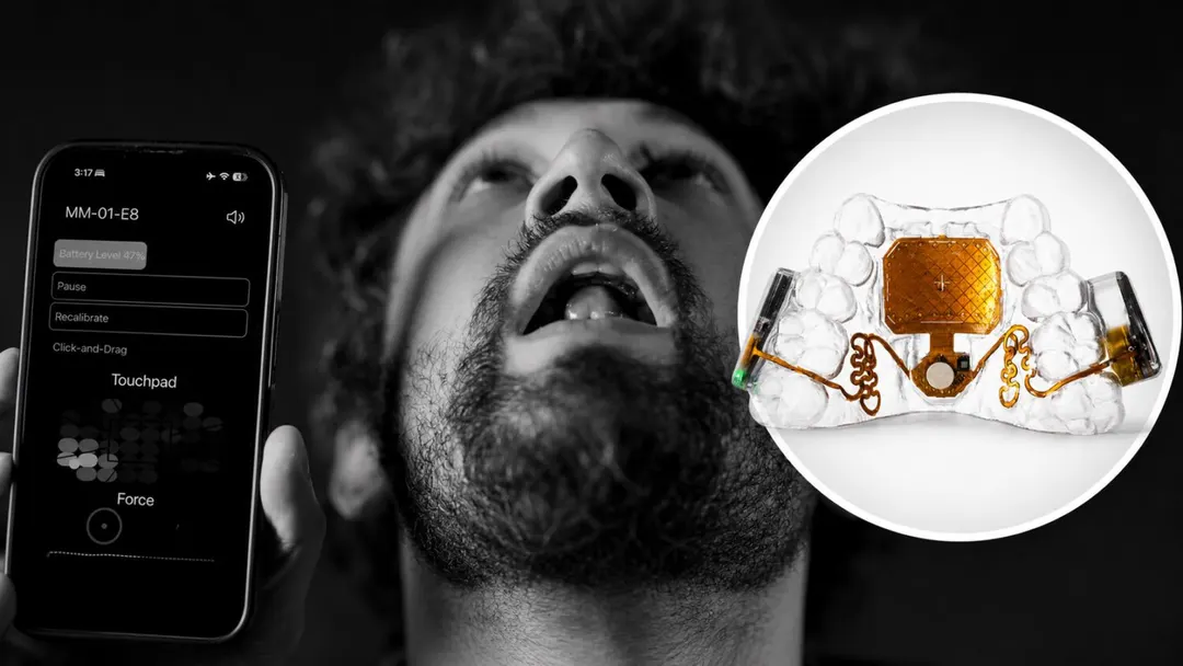 MouthPad: управление устройствами языком за $1400
